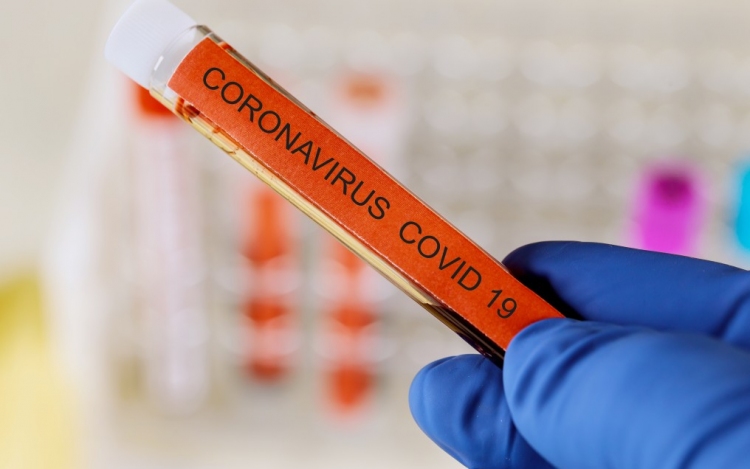 Koronavírus - Csehországban felülvizsgálták a járványadatokat