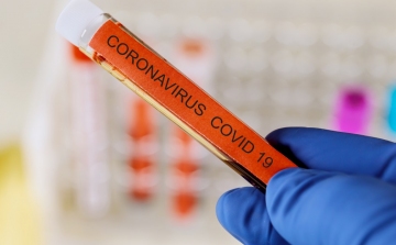 Koronavírus - Csehországban felülvizsgálták a járványadatokat