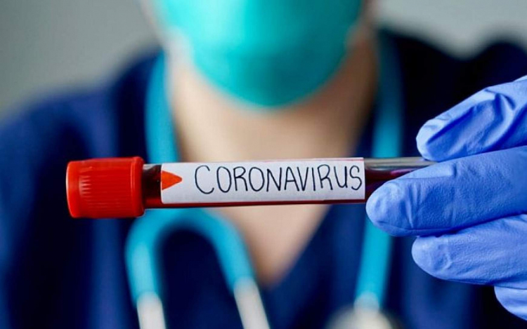 Koronavírus: csütörtöki adatok - A PCR-tesztek majdnem fele lett pozitív