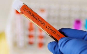 Karanténban egy munkásszálló, 8 szerb vendégmunkás koronavírusos 